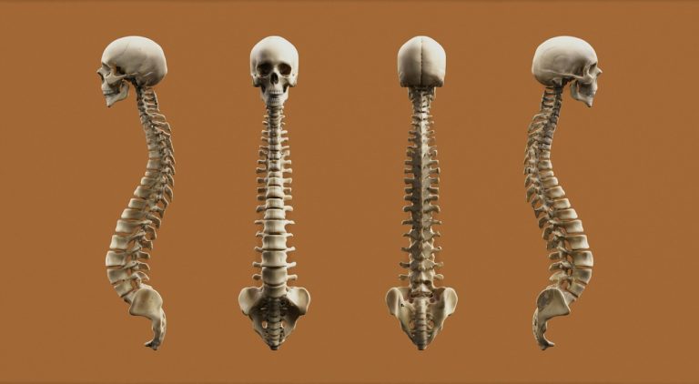 ciri-ciri osteoporosis